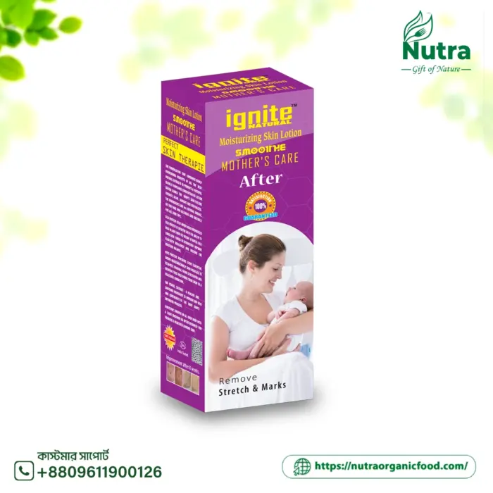 মাদার কেয়ার - Mother Care 100ml (After) - Image 1